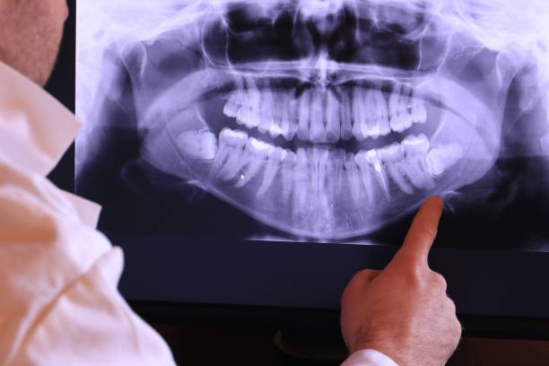 Best Emergency Denture Repair in Balcones Heights, TX
